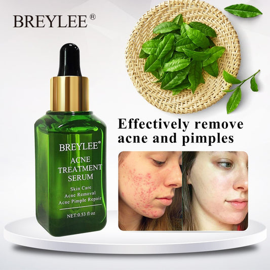 BREYLEE Acne Serum – Anti-Akne & Narbenpflege für klare Haut